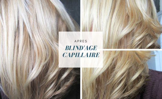 blind'age capillaire EM2H résutats