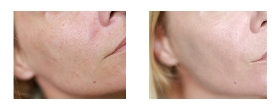 Clarins Skin illusion avant après l'application